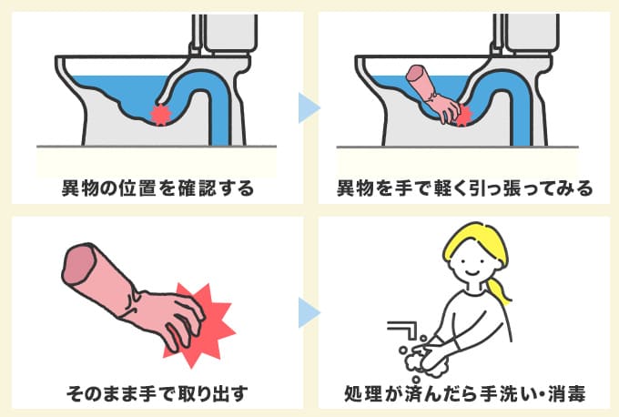 トイレに流した異物（ナプキン・パンツ・おもちゃ）は手で取り出す