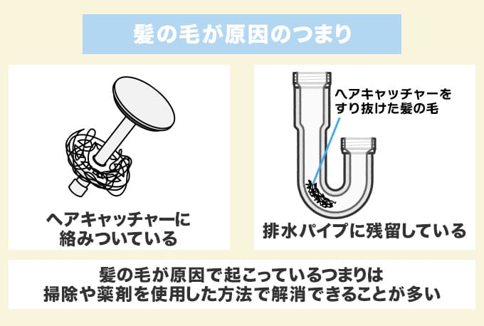 つまりの原因1.髪の毛